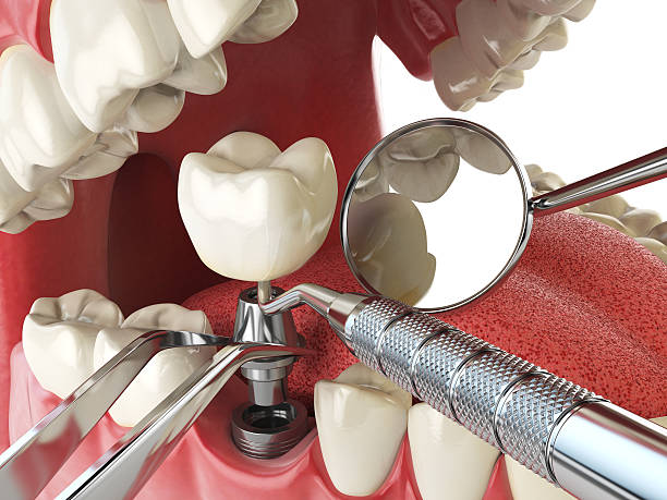 Best Emergency Orthodontic Repairs in Grenelefe, FL